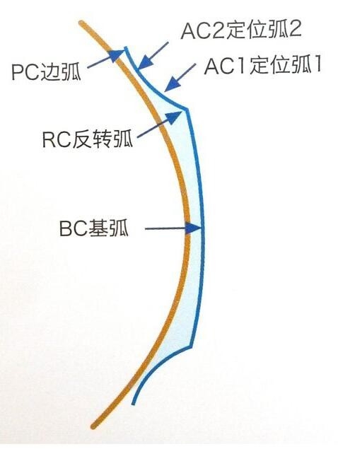 一觉醒来近视不见了 就是这么神奇!