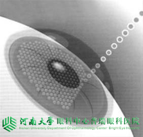 ICL晶体术高度近视好吗