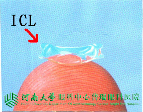 关注高度近视——ICL是个啥？