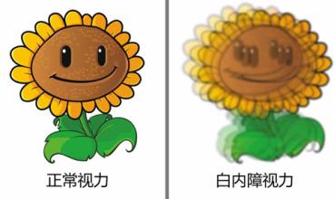 白内障诱发原因大解析