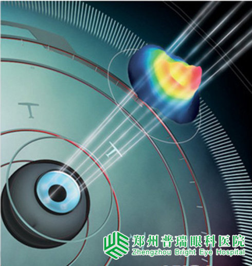 影响屈光手术的主要因素