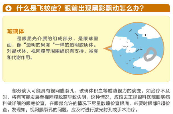 【看图学知识】眼前有黑影该怎么办