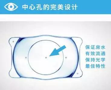 高度近视的“终结者”——ICL晶体植入术！