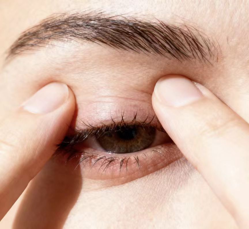 冬季干眼高发，久治不愈或是睫毛上的螨虫在作祟！